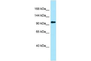 WB Suggested Anti-PKP4 Antibody Titration: 1. (Plakophilin 4 antibody  (N-Term))