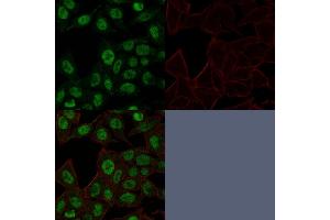 Confocal Immunofluorescence image of HeLa cells using Topo II alpha, Monoclonal Antibody (TOP2A/1361). (Topoisomerase II alpha antibody  (AA 1352-1493))