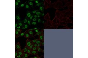 Confocal Immunofluorescence image of HeLa cells using Topo II alpha, Monoclonal Antibody (TOP2A/1361). (Topoisomerase II alpha antibody  (AA 1352-1493))