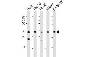 All lanes : Anti-ADORA3 Antibody (C-Term) at 1:2000 dilution Lane 1: Hela whole cell lysate Lane 2: HepG2 whole cell lysate Lane 3: HL-60 whole cell lysate Lane 4: mouse liver lysate Lane 5: SH-SY5Y whole cell lysate Lysates/proteins at 20 μg per lane. (Adenosine A3 Receptor antibody  (AA 202-232))