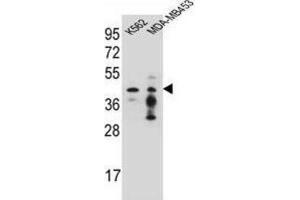 Western Blotting (WB) image for anti-Phosphate Cytidylyltransferase 1, Choline, alpha (PCYT1A) antibody (ABIN2996564)