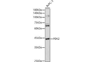 Western blot analysis of extracts of BxPC-3 cells, using PDK2 antibody (ABIN1681304, ABIN3018413, ABIN3018414 and ABIN6220461) at 1:3000 dilution.