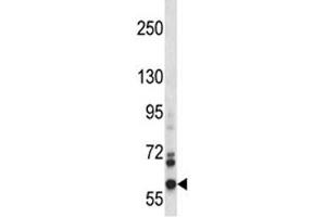 NOX5 antibody western blot analysis in CEM lysate. (NOX5 antibody  (AA 680-709))
