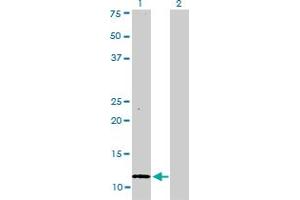 S100A1 antibody  (AA 1-75)