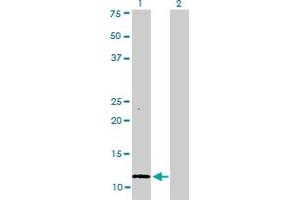 Western Blot analysis of S100A1 expression in transfected 293T cell line by S100A1 monoclonal antibody (M01), clone 1D5. (S100A1 antibody  (AA 1-75))