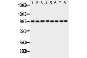 Western Blotting (WB) image for anti-Heat Shock 70kDa Protein 8 (HSPA8) (AA 563-582), (C-Term) antibody (ABIN3044192) (Hsc70 antibody  (C-Term))