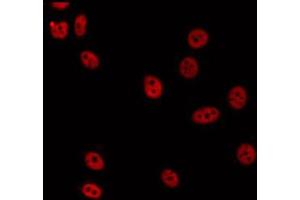 ABIN6274890 staining HepG2 by IF/ICC. (DDX51 antibody  (C-Term))