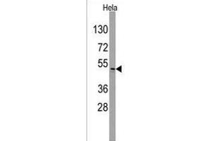 Western blot analysis of anti-ILK Antibody  (ABIN391996 and ABIN2841782) in Hela cell line lysates (35 μg/lane). (ILK antibody  (AA 225-253))