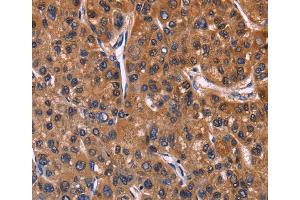 Immunohistochemistry (IHC) image for anti-Nuclear Factor of Activated T-Cells, Cytoplasmic, Calcineurin-Dependent 3 (NFATC3) antibody (ABIN2827896)
