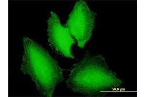 Immunofluorescence of purified MaxPab antibody to NXT1 on HeLa cell.
