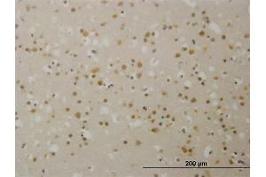 Immunoperoxidase of monoclonal antibody to TBL1X on formalin-fixed paraffin-embedded human cerebral cortex. (TBL1X antibody  (AA 478-577))