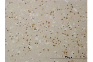 Immunoperoxidase of monoclonal antibody to TBL1X on formalin-fixed paraffin-embedded human cerebral cortex. (TBL1X antibody  (AA 478-577))