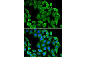Immunofluorescence analysis of  cells using Fas antibody (ABIN6130384, ABIN6140482, ABIN6140483 and ABIN6216020). (FAS antibody  (AA 30-335))