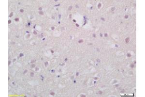 Formalin-fixed and paraffin embedded rat brain labeled with Rabbit Anti-TSHR Polyclonal Antibody (ABIN677378) at 1:200 followed by conjugation to the secondary antibody and DAB staining (TSH receptor antibody  (AA 201-300))
