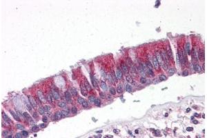 Human Lung, Respiratory Epithelium: Formalin-Fixed, Paraffin-Embedded (FFPE) (CCT2 antibody  (AA 277-473))