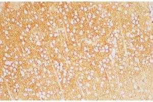 Immunohistochemistry of paraffin-embedded Rat brain using TGFBR1 Polycloanl Antibody at dilution of 1:200 (TGFBR1 antibody)