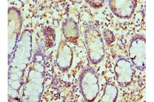 Immunohistochemistry of paraffin-embedded human small intestine tissue using ABIN7146018 at dilution of 1:100 (CCL8 antibody  (AA 23-99))
