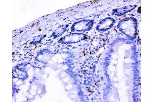 IHC analysis of VIP using anti-VIP antibody (ABIN4886760).