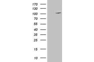 HEK293T cells were transfected with the pCMV6-ENTRY control (Left lane) or pCMV6-ENTRY ERCC4 (Right lane) cDNA for 48 hrs and lysed. (ERCC4 antibody)