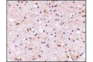 Immunohistochemistry of NPTX2 in human brain with this product at 5 μg/ml. (NPTX2 antibody  (Center))