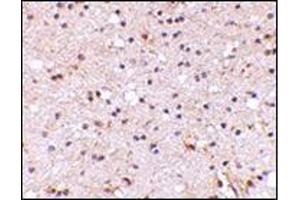 Immunohistochemistry of NPTX2 in human brain with this product at 5 μg/ml.