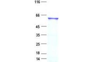 Validation with Western Blot (NKD2 Protein (His tag))