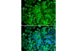 Immunofluorescence analysis of HeLa cells using Galactosidase alpha (Galactosidase alpha (GLA)) antibody (ABIN6131511, ABIN6141114, ABIN6141116 and ABIN6218799). (GLA antibody  (AA 150-429))