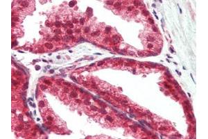 Human Prostate (formalin-fixed, paraffin-embedded) stained with TSLPat 2. (Thymic Stromal Lymphopoietin antibody)