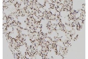 ABIN6276288 at 1/100 staining Rat lung tissue by IHC-P. (ATF4 antibody)