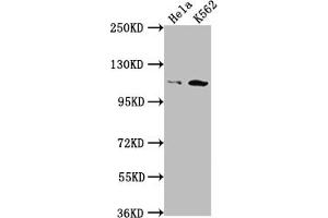 Western Blot Positive WB detected in: Hela whole cell lysate, K562 whole cell lysate All lanes: PIK3CB antibody at 1:1500 Secondary Goat polyclonal to rabbit IgG at 1/50000 dilution Predicted band size: 123 kDa Observed band size: 110 kDa (Recombinant PIK3CB antibody)
