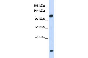 WB Suggested Anti-HEATR4 Antibody Titration: 0. (HEATR4 antibody  (N-Term))