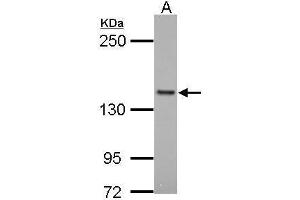 WB Image Sample (30 ug of whole cell lysate) A: Raji 5% SDS PAGE antibody diluted at 1:1000 (Formin-Like 1 antibody)