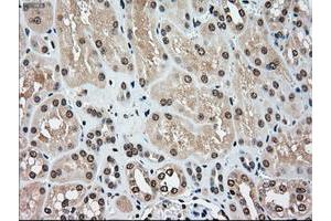 Image no. 2 for anti-Mitogen-Activated Protein Kinase Kinase 4 (MAP2K4) antibody (ABIN1499480) (MAP2K4 antibody)