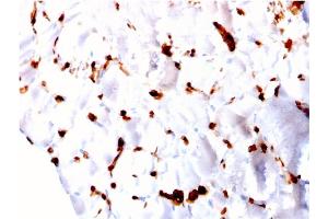 Formalin-fixed, paraffin-embedded human Skeletal Muscle stained with FABP5 Mouse Monoclonal Antibody (CPTC-FABP5-3). (FABP5 antibody)