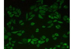 Immunohistochemistry (IHC) image for anti-Latexin (LXN) (AA 1-223) antibody (ABIN7442057)