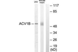 Western blot analysis of extracts from 293/mouse liver cells, using ACV1B Antibody. (Activin A Receptor Type IB/ALK-4 antibody  (AA 73-122))