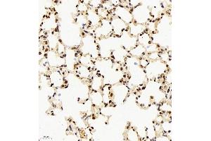 Immunohistochemistry of paraffin embedded mouse lung using rap1 (ABIN7075857) at dilution of 1: 2000 (400x lens) (RAP1 antibody)