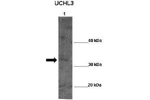 WB Suggested Anti-UCHL5 Antibody  Positive Control: Lane 1:341 µg Zebrafish skin lysate Primary Antibody Dilution: 1:0000Secondary Antibody: Anti-rabbit-HRP Secondry  Antibody Dilution: 1:0000Submitted by: William Tse (UCHL5 antibody  (Middle Region))