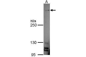 WB Image Sample (30 ug of whole cell lysate) A: A549 7. (MUC4 antibody)