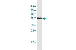 Western Blot detection against Immunogen (37. (PAGE4 antibody  (AA 1-102))