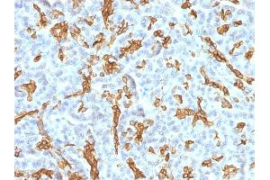 Formalin-fixed, paraffin-embedded human Pancreas stained with Cytokeratin 19 MAb (KRT19/799 + KRT19/800) (Cytokeratin 19 antibody)