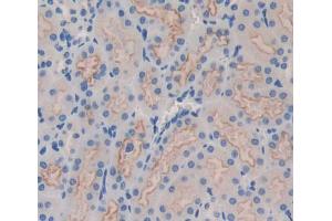 Used in DAB staining on fromalin fixed paraffin- embedded kidney tissue (IRS4 antibody  (AA 1-299))