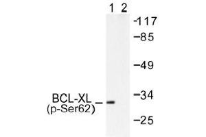 Image no. 1 for anti-BCL2-Like 1 (BCL2L1) (pSer62) antibody (ABIN317973) (BCL2L1 antibody  (pSer62))