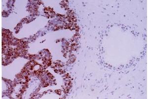 Image no. 4 for anti-Apurinic/Apyrimidinic Endonuclease 1 (APEX1) antibody (ABIN363379)