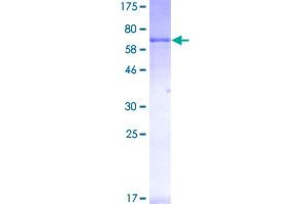 Ret Proto-Oncogene Protein (RET) (AA 25-458) (GST tag)