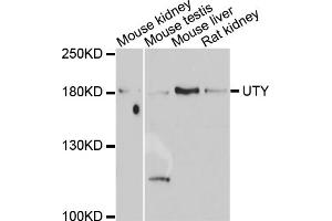 Western blot analysis of extracts of various cell lines, using UTY antibody. (UTY antibody)