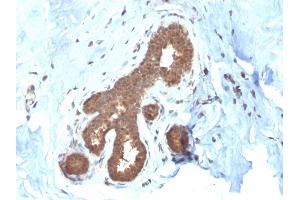 Formalin-fixed, paraffin-embedded human Breast Carcinoma stained with GSTMu2 Mouse Monoclonal Antibody (CPTC-GSTMu2-2). (GSTM4 antibody)