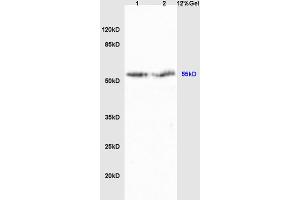 Lane 1: rat liver lysates Lane 2: rat brain lysates probed with Anti Cyp2-j3 Polyclonal Antibody, Unconjugated (ABIN872965) at 1:200 in 4 °C. (Cytochrome P450, Family 2, Subfamily J, Polypeptide 3 (CYP2J3) (AA 401-502) antibody)