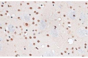 Immunohistochemistry of paraffin-embedded Mouse brain using RBM3 Polyclonal Antibody at dilution of 1:100 (40x lens). (RBM3 antibody)