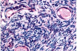 Human Ovary, Oocytes (formalin-fixed, paraffin-embedded) stained with TMEM5 antibody ABIN213422 at 10 ug/ml followed by biotinylated goat anti-rabbit IgG secondary antibody ABIN481713, alkaline phosphatase-streptavidin and chromogen. (TMEM5 antibody  (Extracellular Domain))